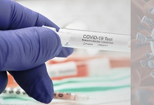 Prohíben comercializar al público pruebas rápidas para detección del Covid19 en Colombia